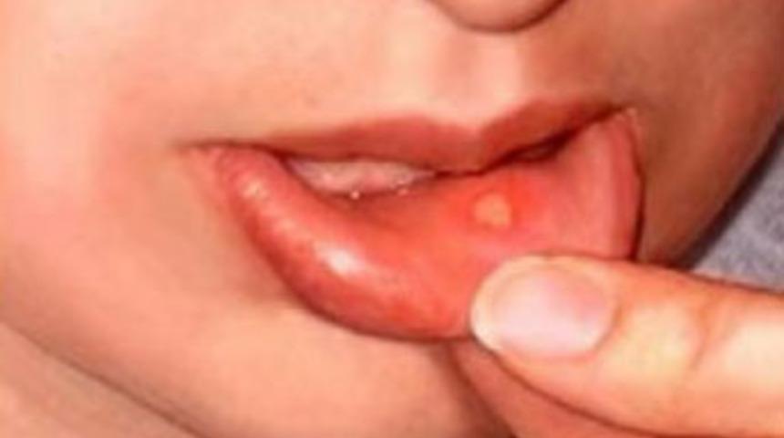 Aft, hakkında bilinmesi gerekenler