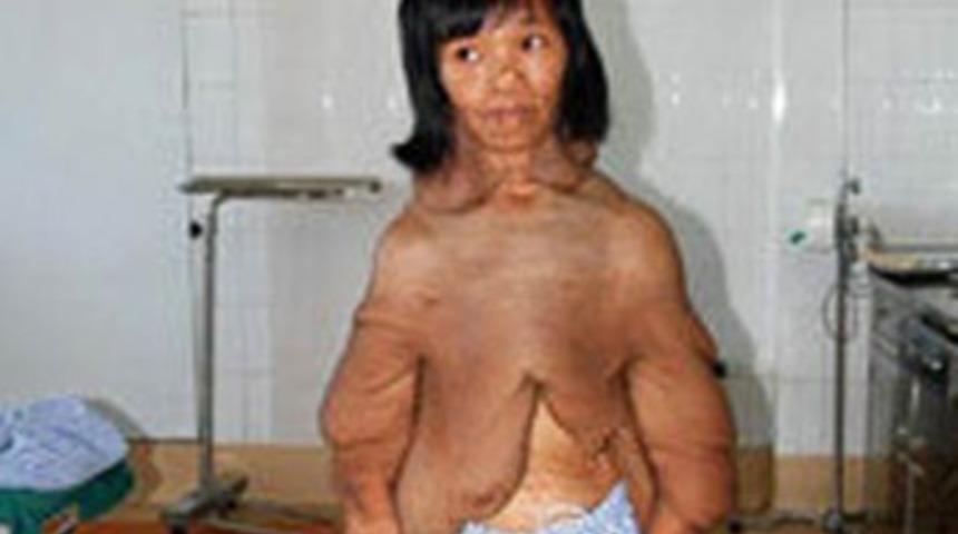 Vücudu tereyağı gibi eriyor!