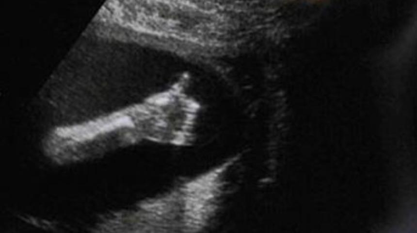 Anneye mesaj: Ben iyiyim