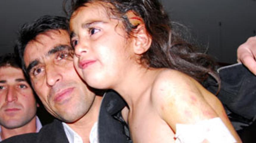 Köpeğin ağzında 100 metre sürüklendi