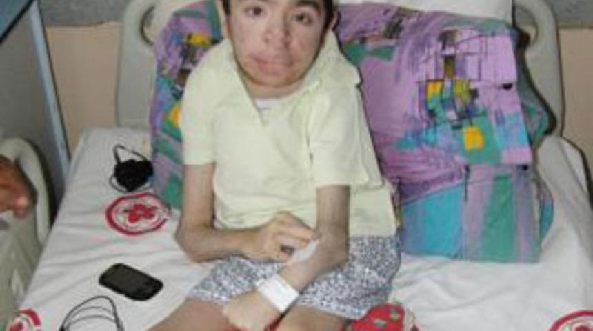 Bu hastalık d&uuml;nyada sadece 50 kişide var!