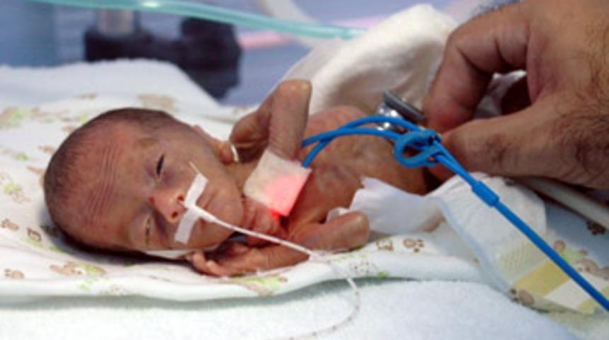 Parmak bebek hayatını kaybetti