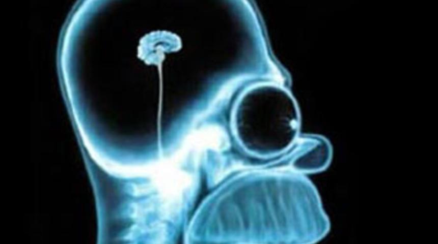 Beynin küçülmesi uygarlık işareti