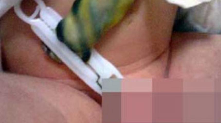 Doğuştan Fenerli bebek