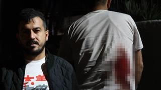 Oğuz Erge olayının yankıları sürerken... yine İzmir! Taksicinin sırtına makas sapladı