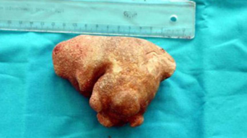 İnanılmaz ama ger&ccedil;ek!