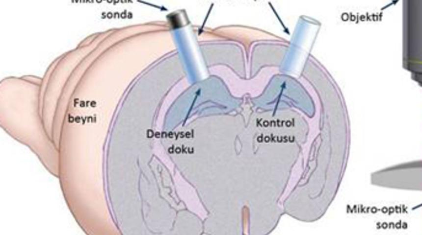 Beynin derinliklerine seyahat