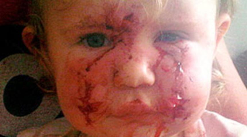 Kuyruğuna basan bebeği bu hale getirdi