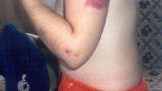 Özürlü kıza işkence iddiası