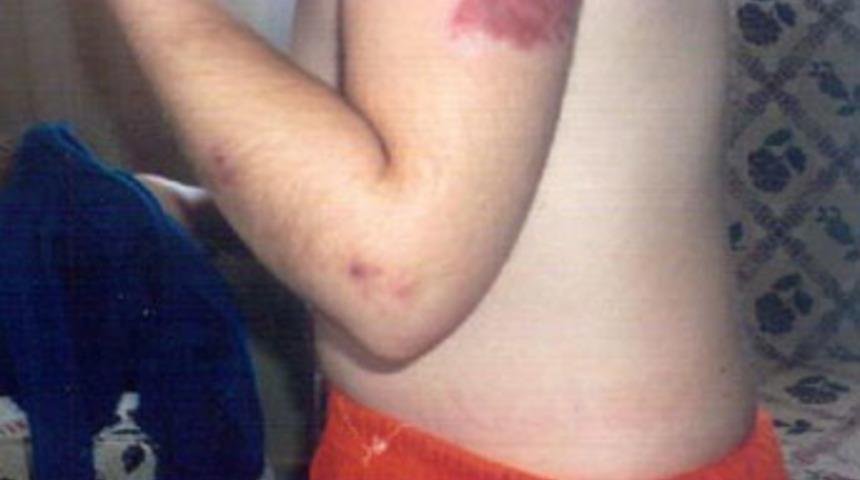 Özürlü kıza işkence iddiası