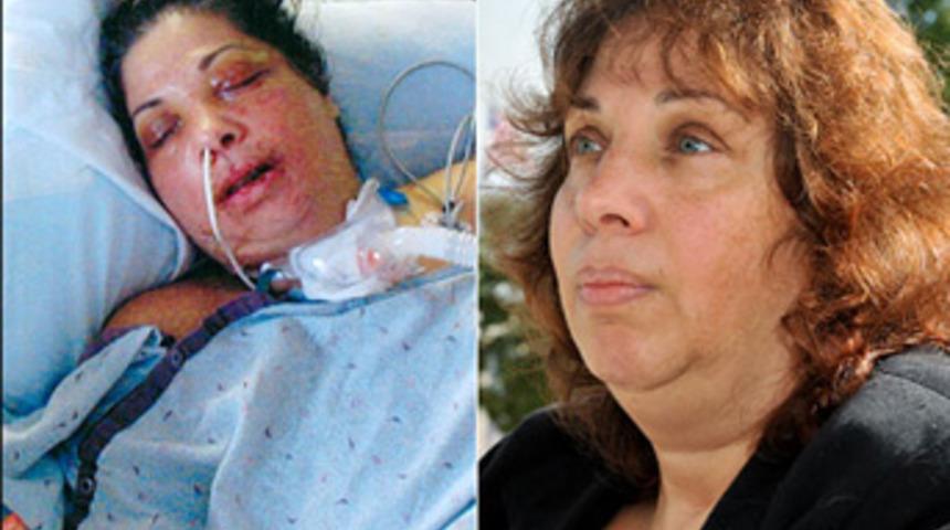 Onu bu hale bir hindi getirdi