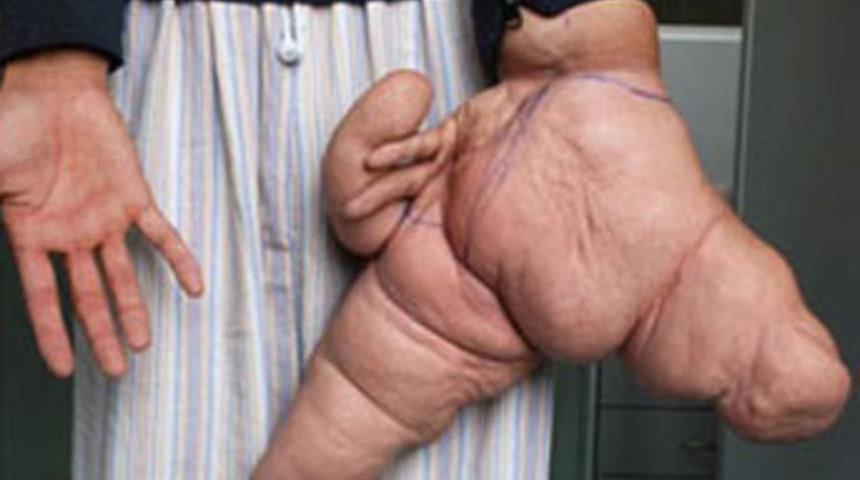 İşte d&uuml;nyanın en b&uuml;y&uuml;k eli