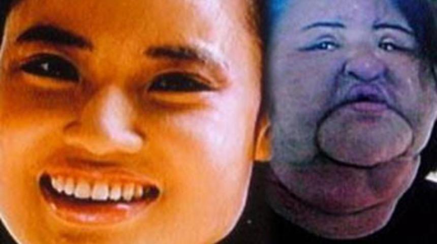 Estetik onu bu hale getirdi!