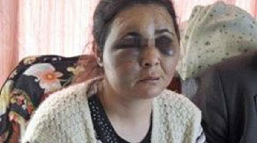 Dayak&ccedil;ı kocadan jandarma kurtardı