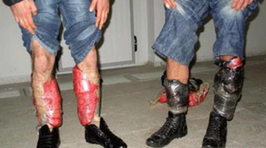 Et ka&ccedil;ak&ccedil;ılığında son nokta