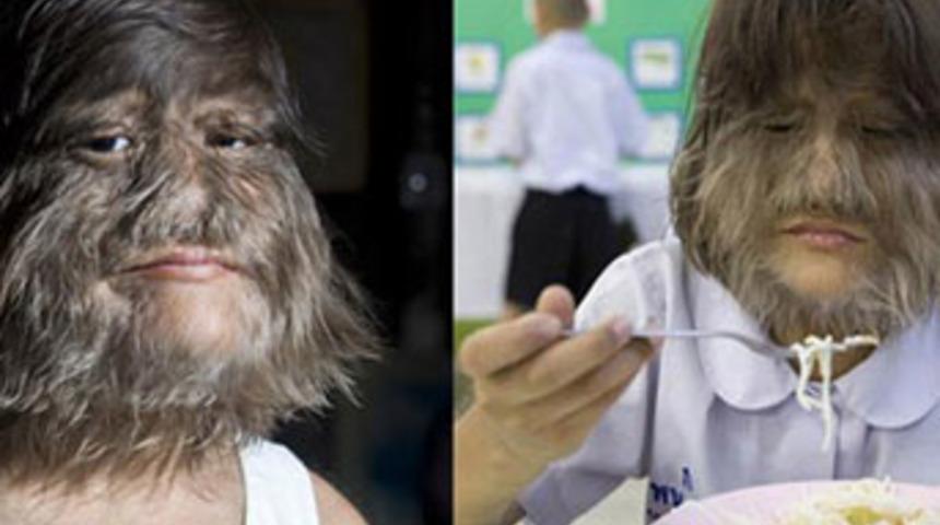 Bu 'kurt adam' aslında k&uuml;&ccedil;&uuml;k bir kız