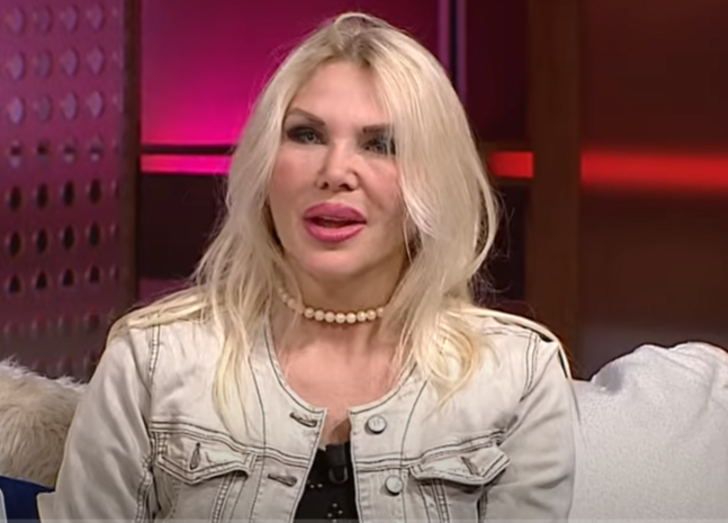 Kocası "Göğüslerin büyük kocaman olsun" dedi! Esra Ezmeci'ye katılan kadın estetikle tamamen değişti değişmesine ama... G1