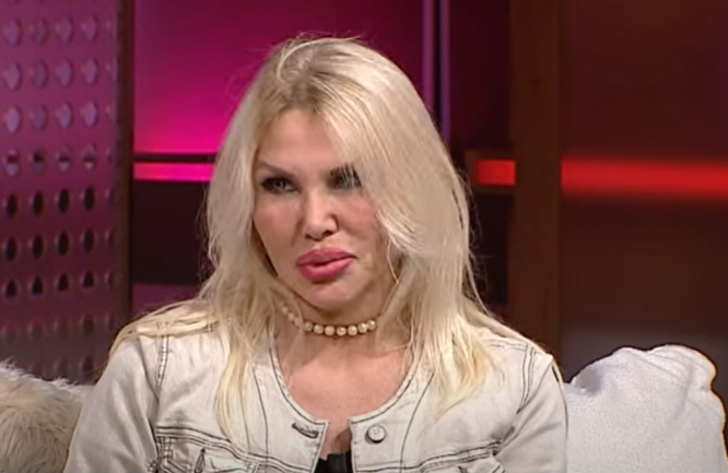 Kocası "Göğüslerin büyük kocaman olsun" dedi! Esra Ezmeci'ye katılan kadın estetikle tamamen değişti değişmesine ama... G2