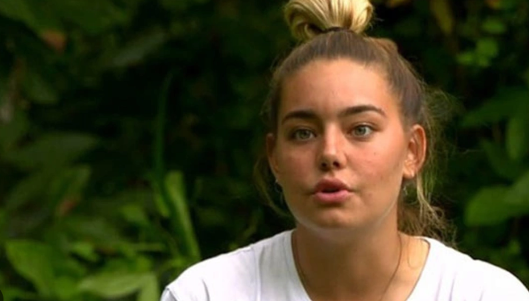 Survivor Aycan Yana&ccedil;'ın son hali g&uuml;ndem oldu! Dudaklarındaki değişim dikkat &ccedil;ekti 