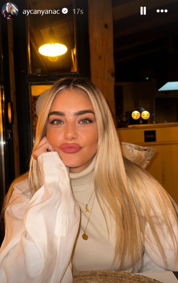 Survivor Aycan Yanaç'ın son hali gündem oldu! Dudaklarındaki değişim dikkat çekti  G1