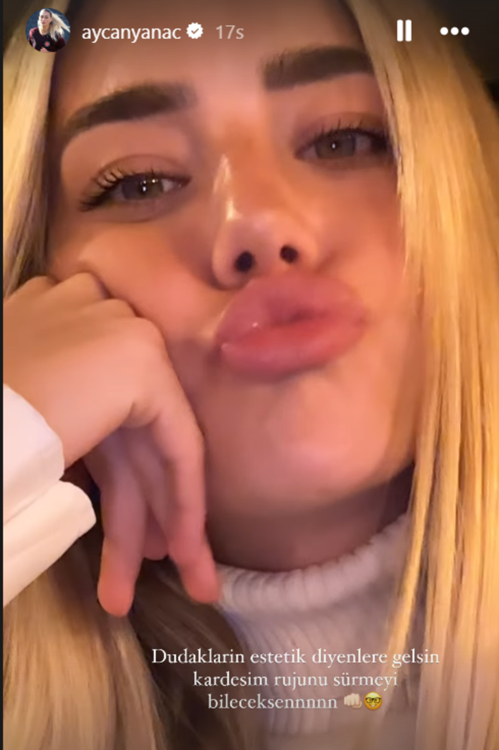 Survivor Aycan Yanaç'ın son hali gündem oldu! Dudaklarındaki değişim dikkat çekti  G2