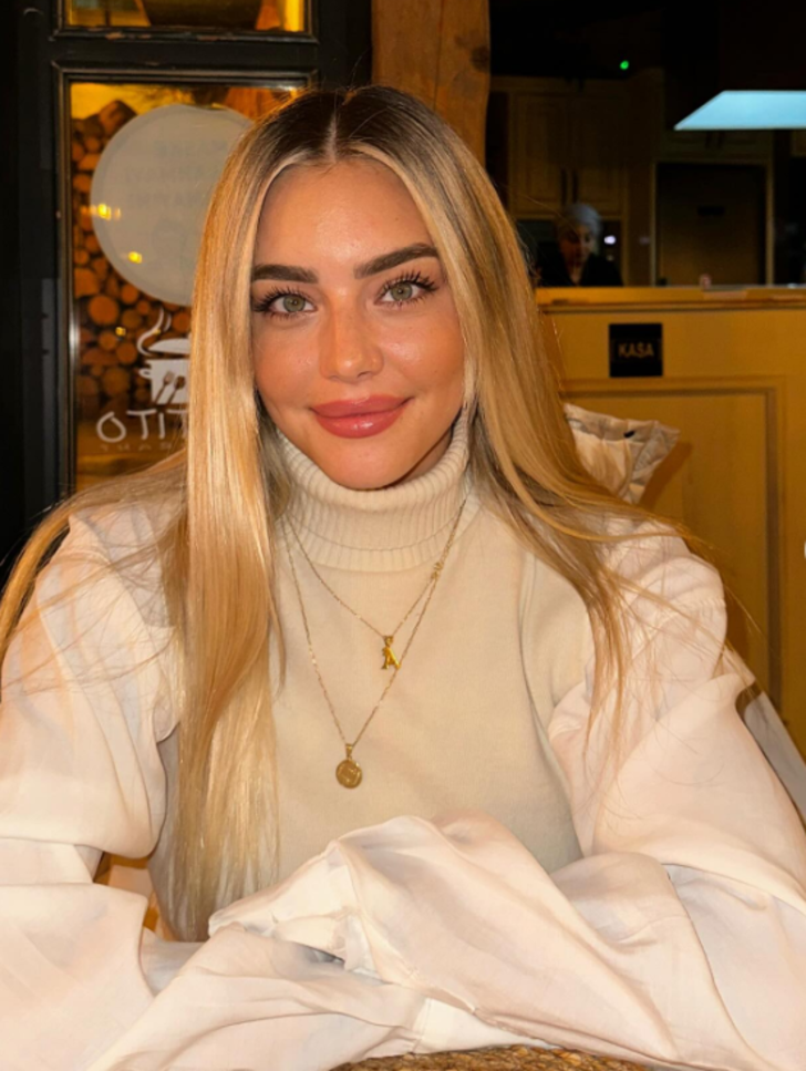 Survivor Aycan Yanaç'ın son hali gündem oldu! Dudaklarındaki değişim dikkat çekti  G3