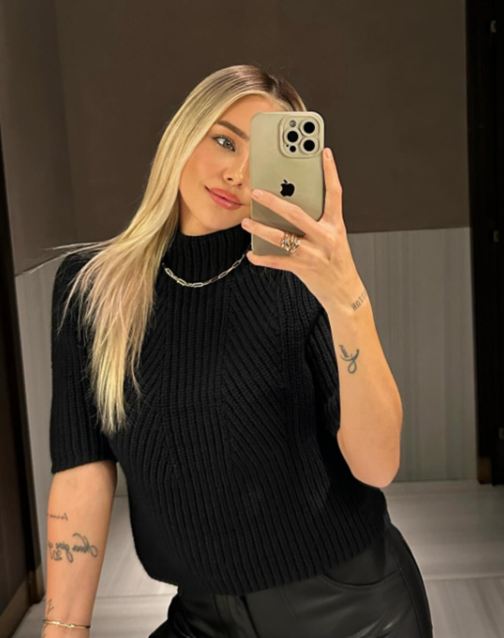 Survivor Aycan Yanaç'ın son hali gündem oldu! Dudaklarındaki değişim dikkat çekti  G4