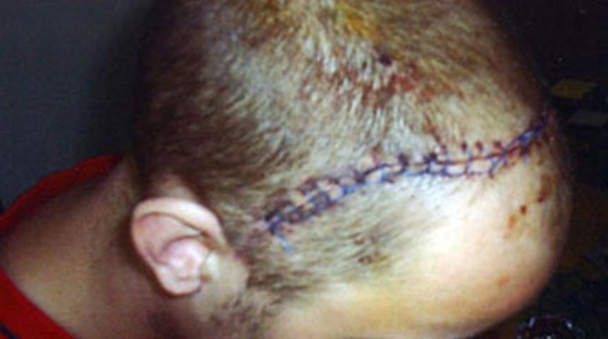 Bakışını beğenmedi, bu hale getirdi!