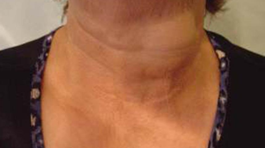 Guatr&rsquo;ı ihmal etmeyin!