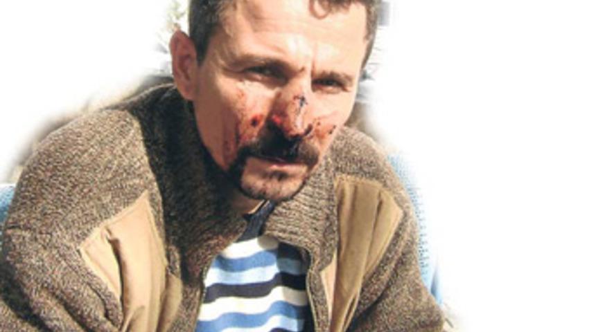 Karakolda 155'i aradı: "Korkma kamera var"