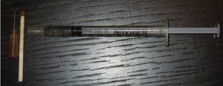 Makat &ccedil;atlağı i&ccedil;in Botoks tedavisi