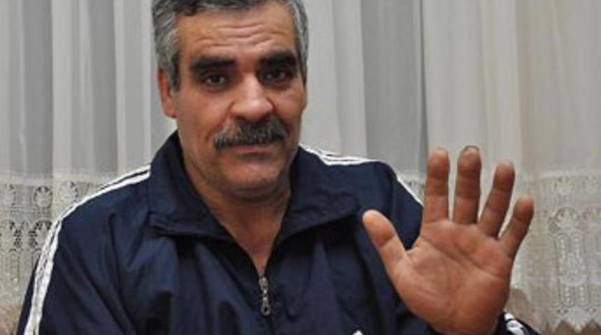 &lsquo;Parmağım &uuml;ş&uuml;yor&rsquo; dedi, elinde vida &ccedil;ıktı