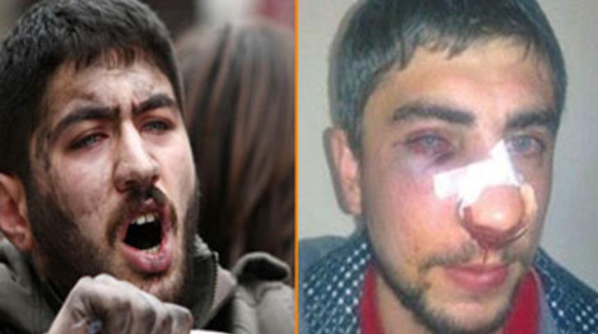 Polis portakal gazı mı kullandı?