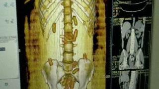 Her yerinden kokain çıktı!