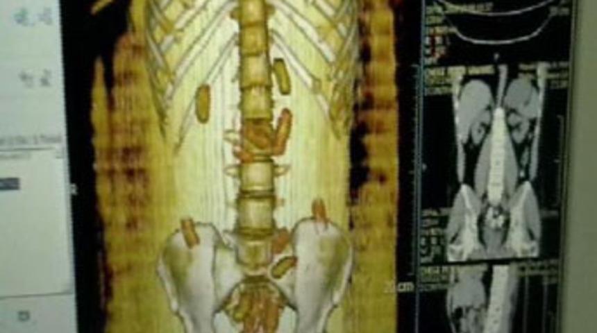 Her yerinden kokain çıktı!