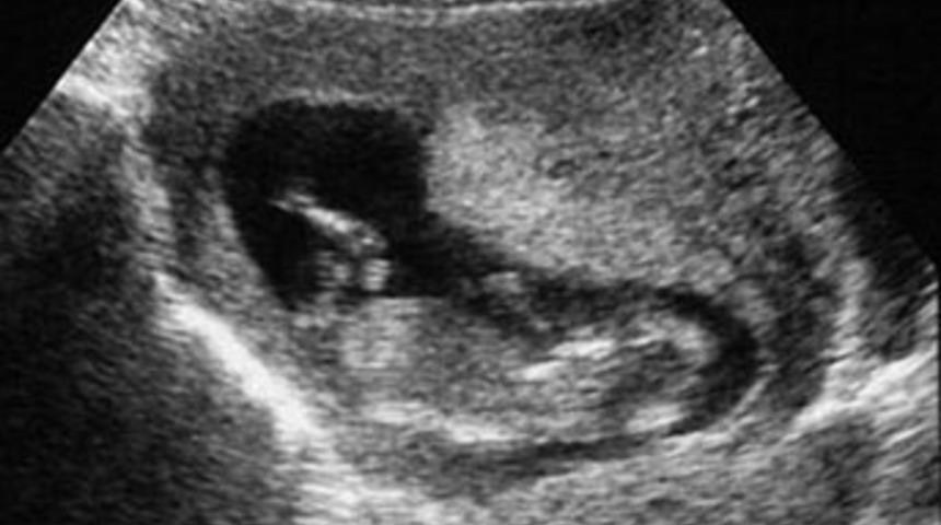 Dokuz haftalık cenin ifade verecek!