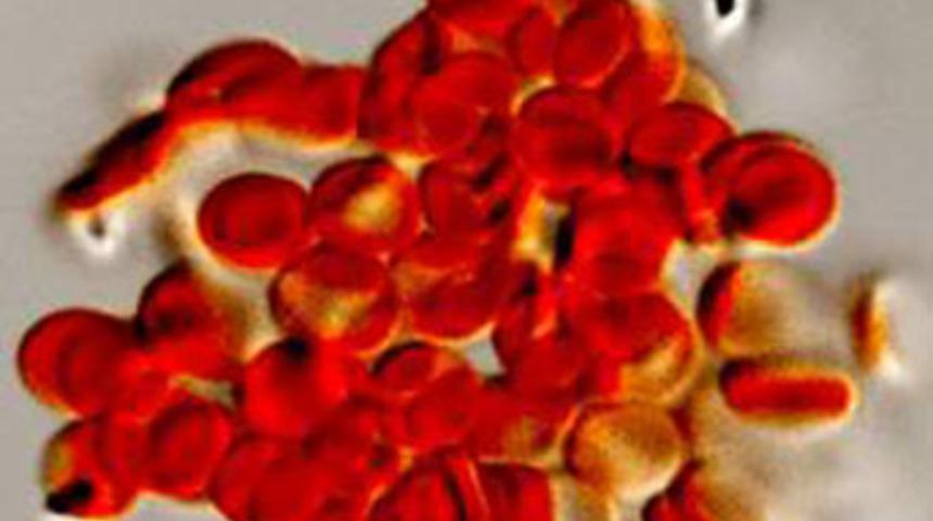 Kanserde &ccedil;ığır a&ccedil;abilir