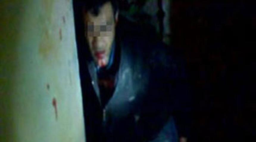 Hırsızın feryadı: Bana iğne yapın