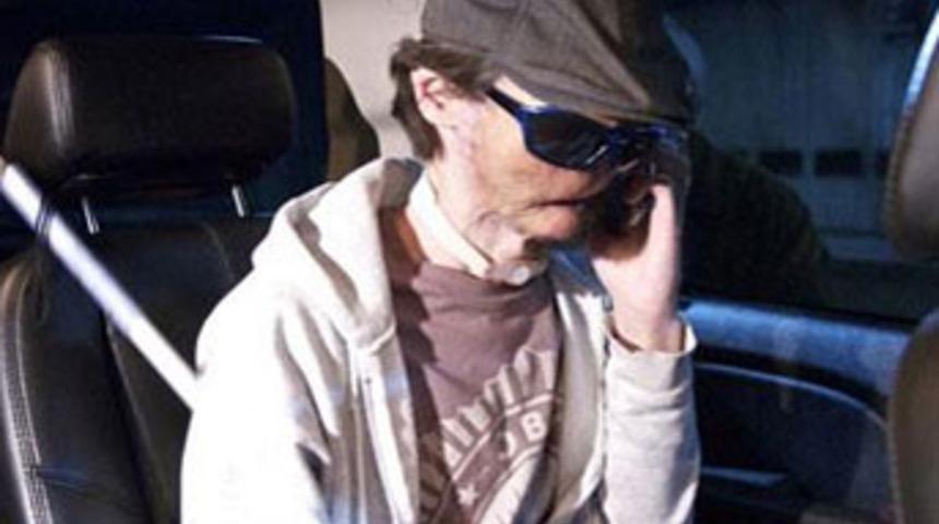 ABD&rsquo;de ilk tam y&uuml;z nakli yapıldı