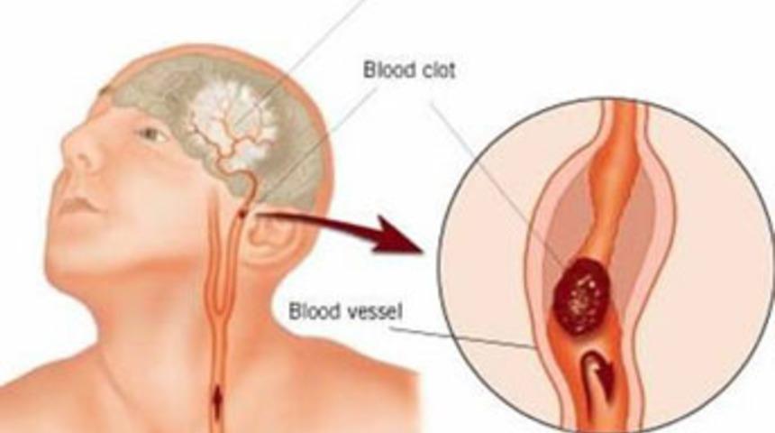 Fel&ccedil; ge&ccedil;iren herkes sakat mı kalır?