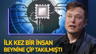 İlk kez insan beynine çip takılmıştı! Tüm dünya hayrete düşecek... Herkes merak ediyordu, Elon Musk: Sadece düşünerek hareket ettirebiliyor