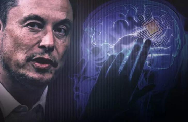 İlk kez insan beynine çip takılmıştı! Tüm dünya hayrete düşecek... Herkes merak ediyordu, Elon Musk: "Sadece düşünerek hareket ettirebiliyor" G2