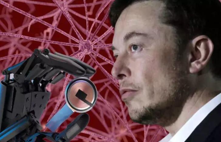 İlk kez insan beynine çip takılmıştı! Tüm dünya hayrete düşecek... Herkes merak ediyordu, Elon Musk: "Sadece düşünerek hareket ettirebiliyor" G5