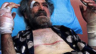 Karikatüristin ellerini kırdılar