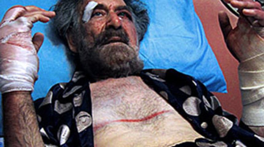 Karikatüristin ellerini kırdılar