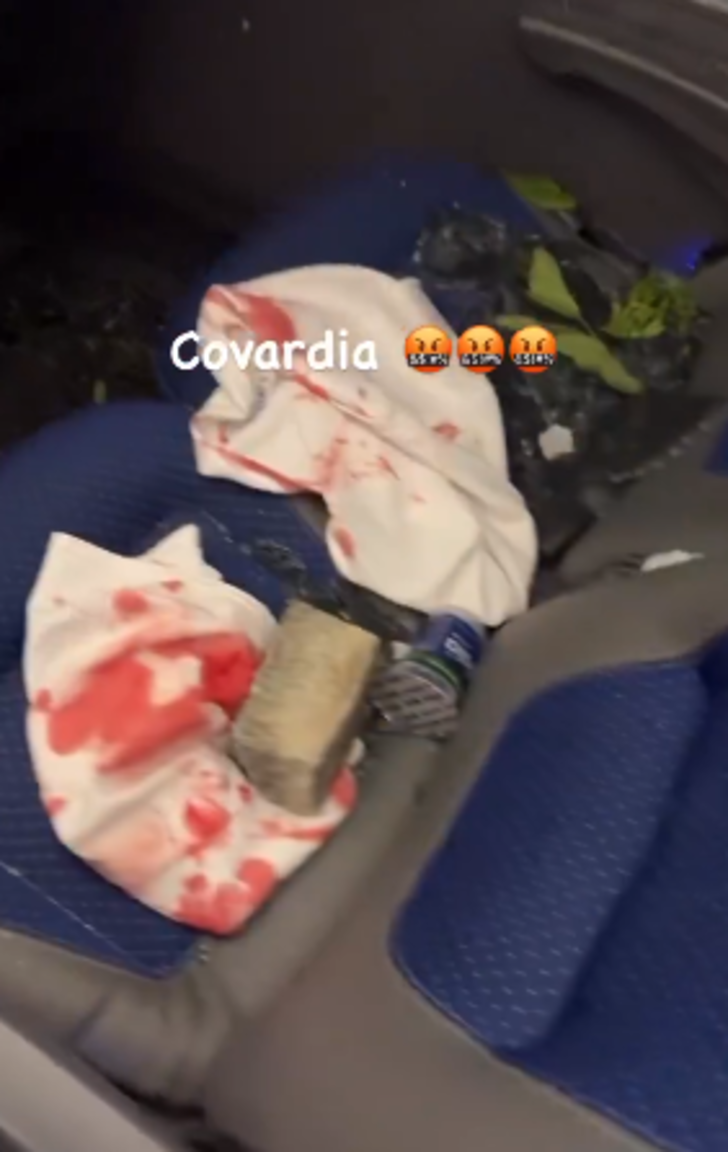 Brezilya'da oynanan futbol maçının ardından takım otobüsüne bombalı saldırı düzenlendi! Çok sayıda yaralı var... G4