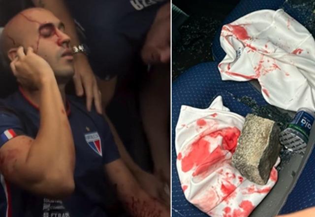 Brezilya'da oynanan futbol maçının ardından takım otobüsüne bombalı saldırı düzenlendi! Çok sayıda yaralı var...