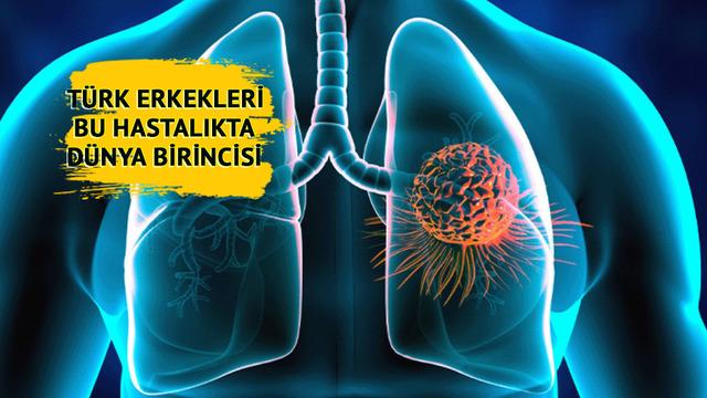 Türk erkekleri dünya birincisi! Ölüm hızı sıralamasında Türkiye 4’üncü sırada... Bu belirtiler varsa vakit kaybetmeyin