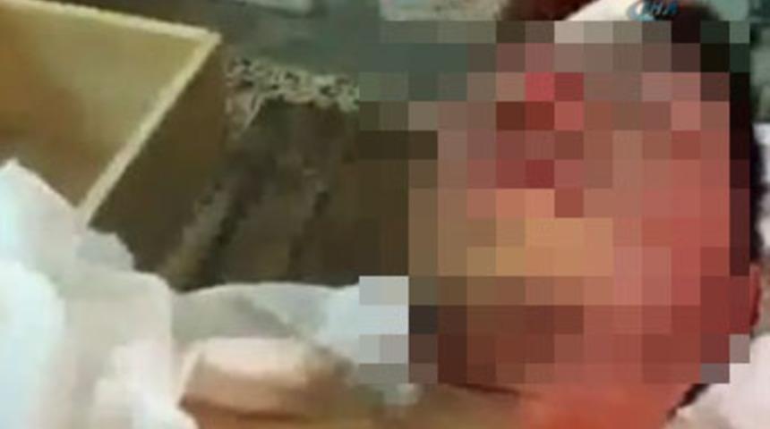 Suriye organ pazarına döndü!