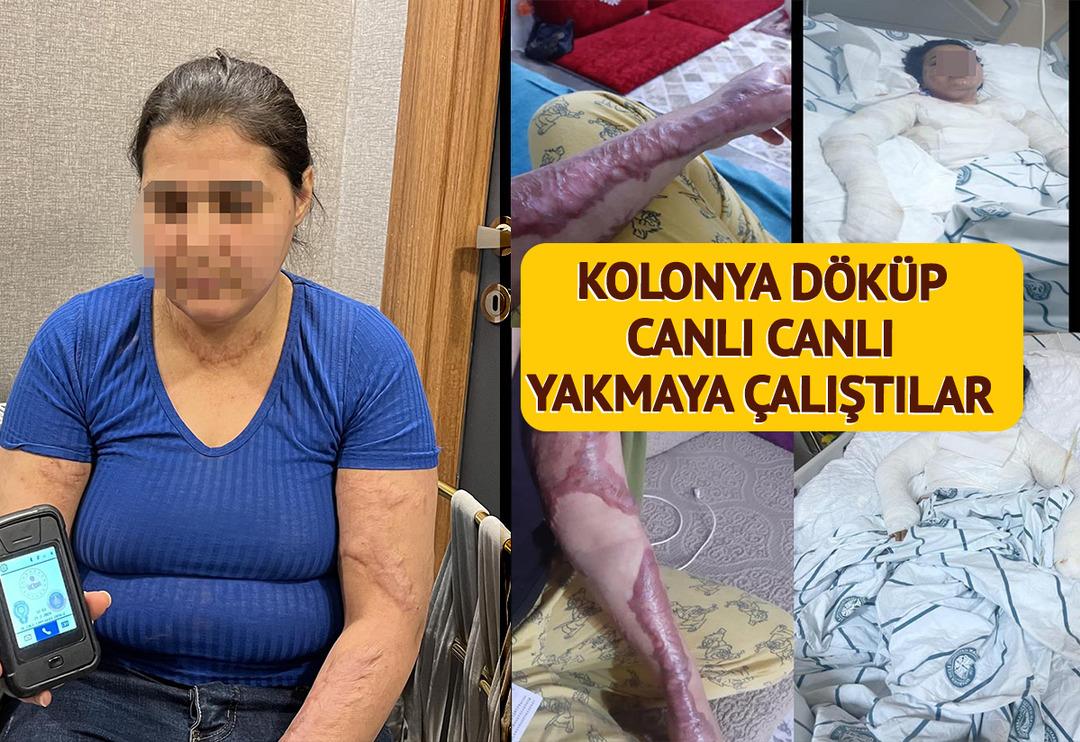 Her kelimesi insanlık dışı: Bacağına sıcak &uuml;t&uuml; bastılar, kolonya d&ouml;k&uuml;p canlı canlı yakmak istediler